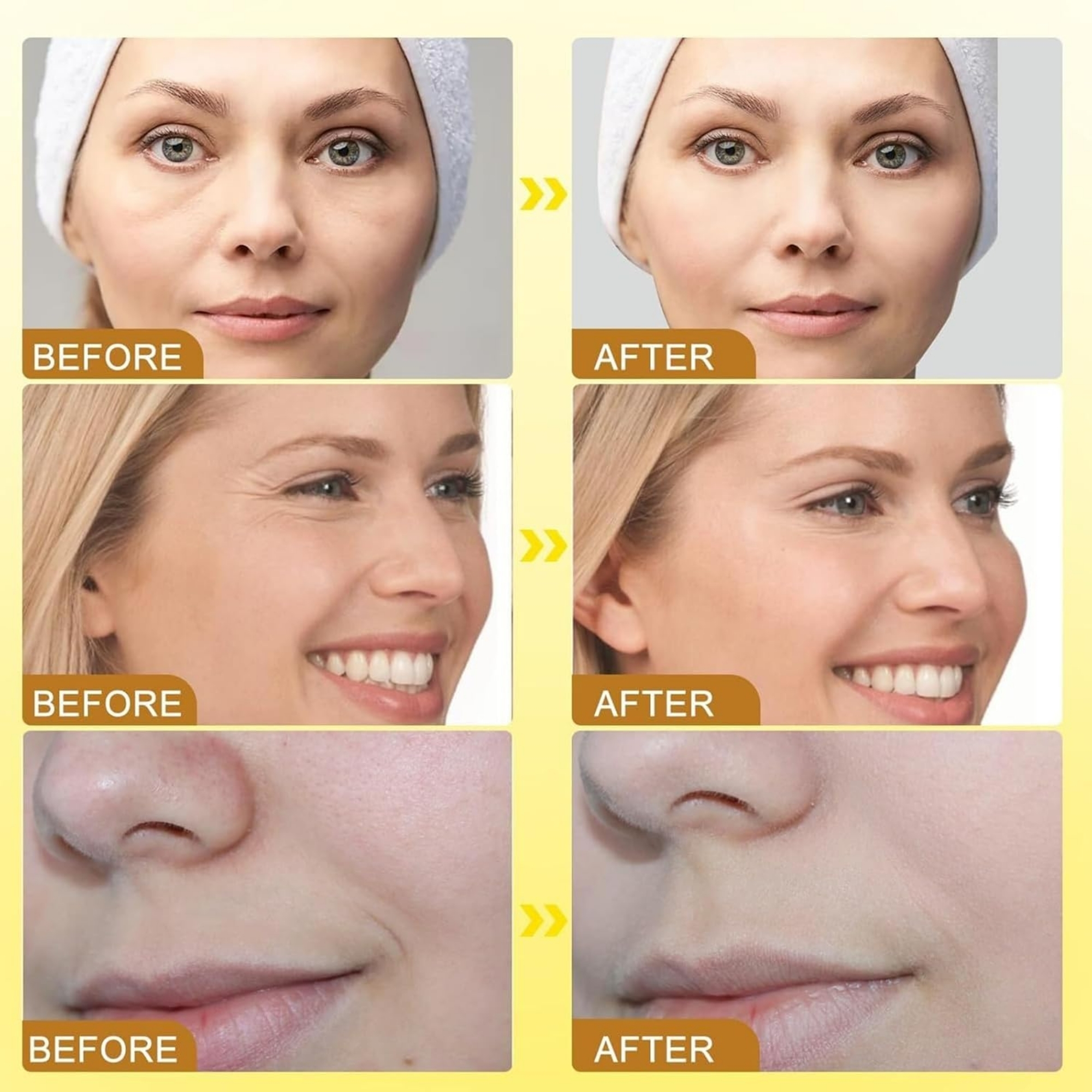 botox9_1757932217.jpg